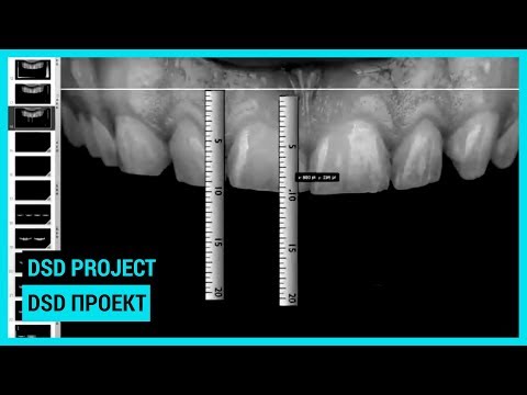 DSD project. DSD проект
