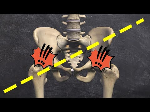 One leg Shorter Than The Other: How to Fix Short Leg At Home