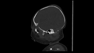 Case of the Day - 13 Nov 24