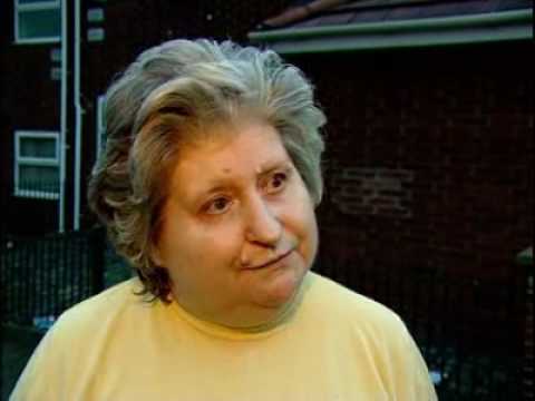 Blast injures welder