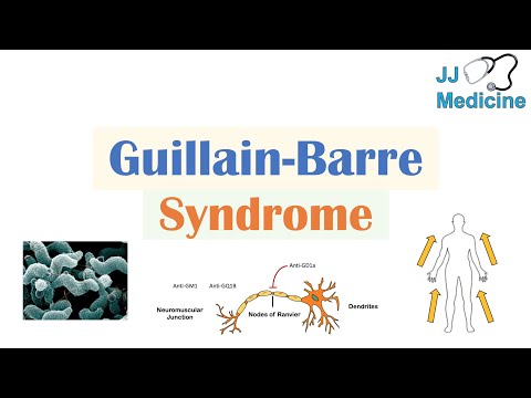 Guillain-Barré-Syndrom (GBS) | Ursachen, Pathophysiologie, Anzeichen und Symptome, Diagnose, Beha...