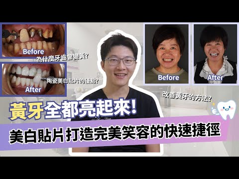 - YouTube