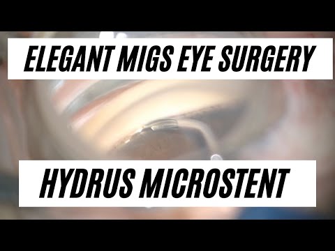 MIGS and Hydrus - Elegant Minimally Invasive Glaucoma Surgery // Your Eyes Tell