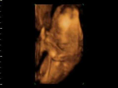 sharon and scott 4d baby scan
