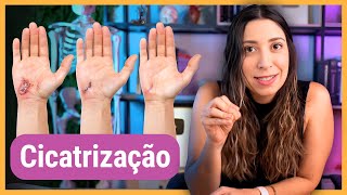 CICATRIZAÇÃO: definição, fases e fatores que influenciam