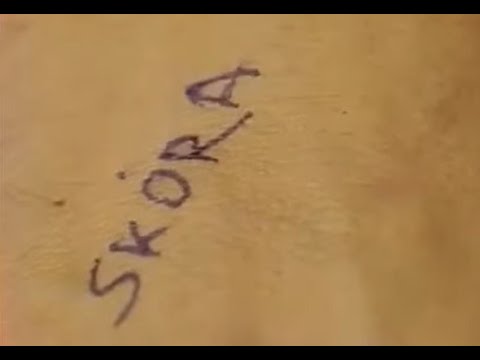 SONDA Skóra (270) budowa skóry, mieszkańcy skóry i środowisko (mikroklimat) | Sonda Program TV