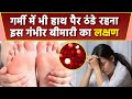 गर्मी में भी हाथ पैर ठंडे रहना Anemia Symptoms ग�