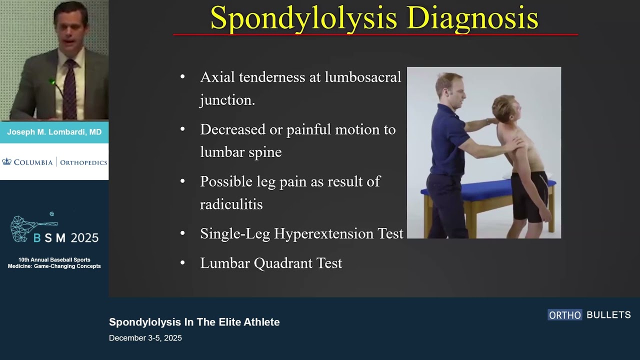 Spondylolysis in the Elite Athlete_Joseph M. Lombardi MD