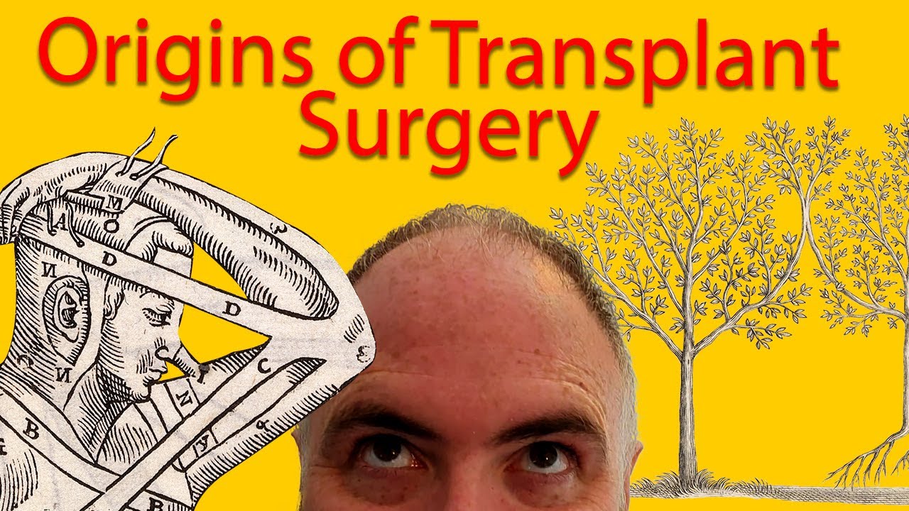 1: The Origins of Transplant Surgery