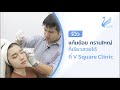 เมโสแฟต ยี่ห้อไหนดี