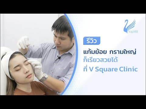 เมโสแฟต ยี่ห้อไหนดี