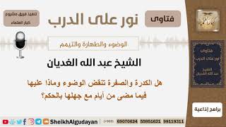 صورة هل الكدرة والصفرة تنقض الوضوء وماذا عليها فيما مضى من أيام مع جهلها بالحكم؟ الغديان - كبار العلماء