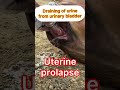 Uterine Prolapse L Dr Umar Khan