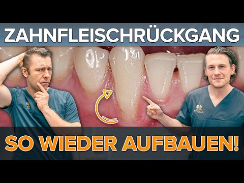 ZAHNFLEISCHRÜCKGANG ? Zahnfleisch wieder aufbauen mit Rezessionsdeckung! So funktioniert es ✅