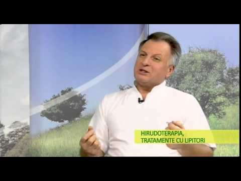 Mereu in Forma - Hirudoterapia tratament cu lipitori