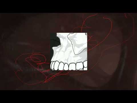 Scrupz - Headshot [Grime/Drill Instrumental]