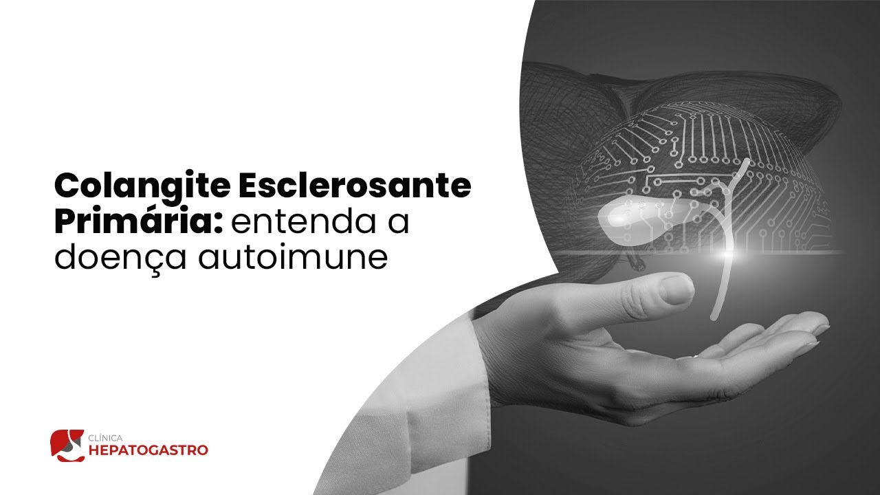 Colangite Esclerosante Primária: entenda a doença autoimune | Clínica Hepatogastro