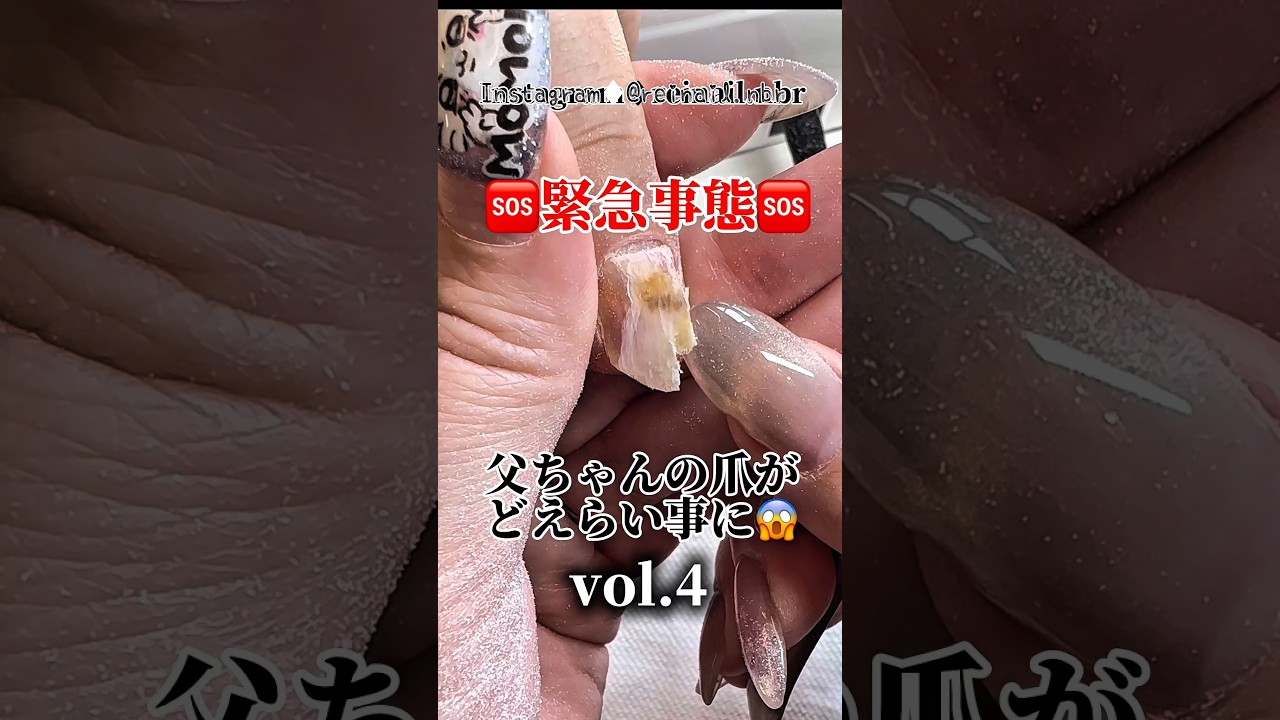 【爪トラブル】爪の復活劇？！【vol.4】ネイルケアの出来るジェルネイル💅 #ルミナジェル