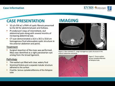 Thumbnail image of video presentation for Developing a Differential Diagnosis of Cystic Lesions in the Abdomen