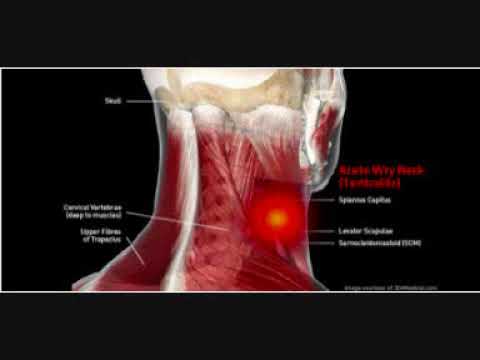 Cliniche specializzate per il trattamento della colonna vertebrale e delle articolazioni Propoli malattie delle articolazioni