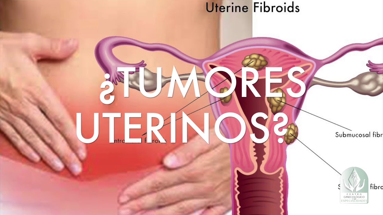 Ramón Bejarano Blanes-16