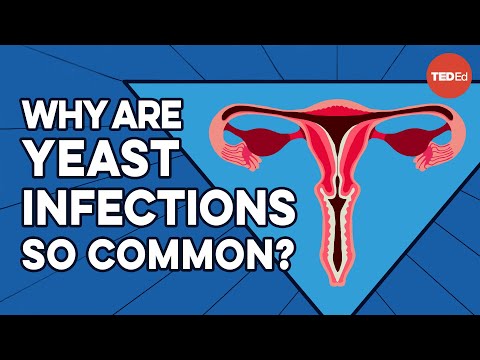 What causes yeast infections, and how do you get rid of them? - Liesbeth Demuyser