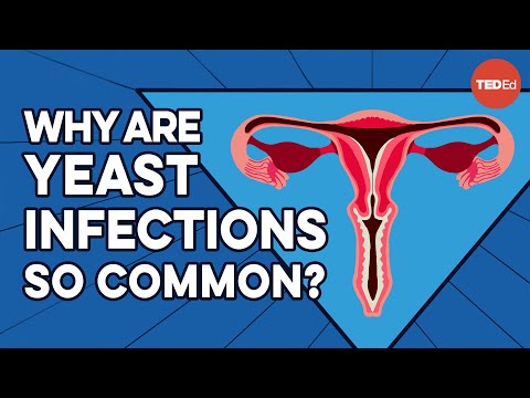 What causes yeast infections, and how do you get rid of them - Liesbeth Demuyser