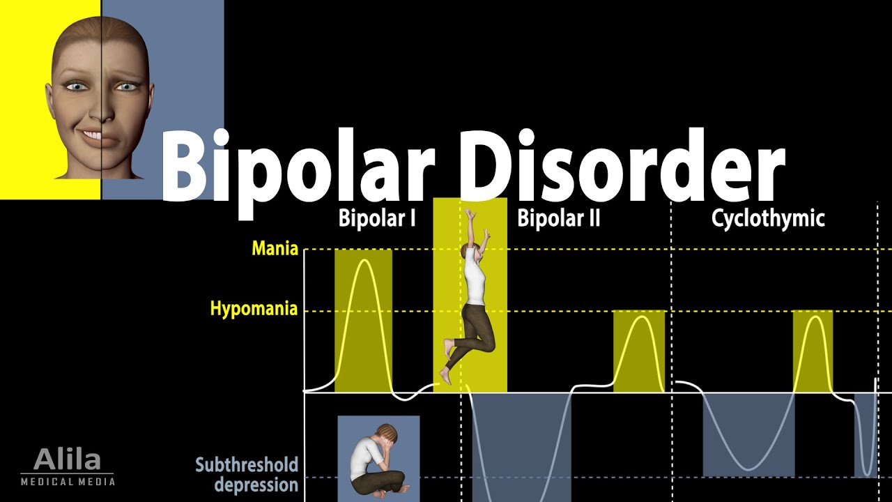 Putar video Apa Itu Gejala Bipolar sekarang Apa Itu Gejala Bipolar