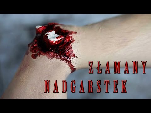 Blokada koślawe zniekształcenie palucha kupić Zapobieganie kości na palucha