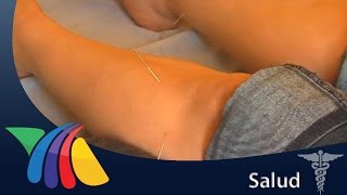 La acupuntura alivia también dolores de cabeza y migrañas | Noticias de Chihuahua