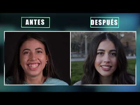 CARILLAS ANTES Y DESPUES