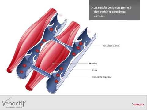 comment guerir une thrombose veineuse