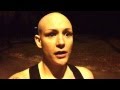 Alopecia journey video #2 please subscribe and ...