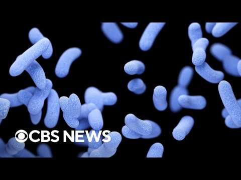 What we know about the apparent plague death in Russia