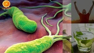 The Strongest Natural Home Remedy for H. Pylori