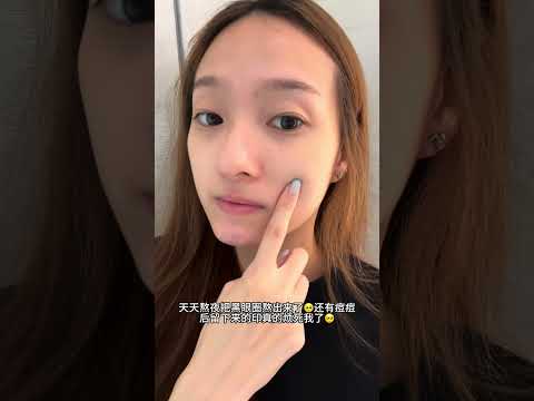 天天熬夜把黑眼圈熬出来了，还有痘印真的烦死了！找MUSE来帮助我的皮肤！