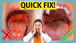 Strep Throat - treat it fast (learn how)