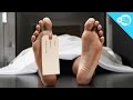 How Is An Autopsy Performed