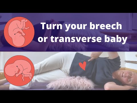 Physical therapy 💕 Breech baby 💕Transverse baby 💕 Psoas release
