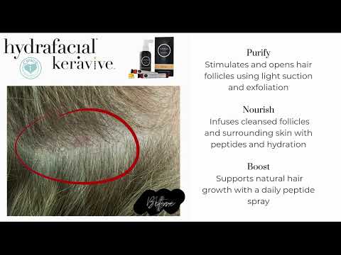 Hydrafacial at Clinica Medica