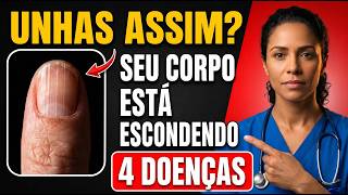 Médico alerta: se suas UNHAS têm essa aparência, seu corpo pode estar escondendo 4 doenças.