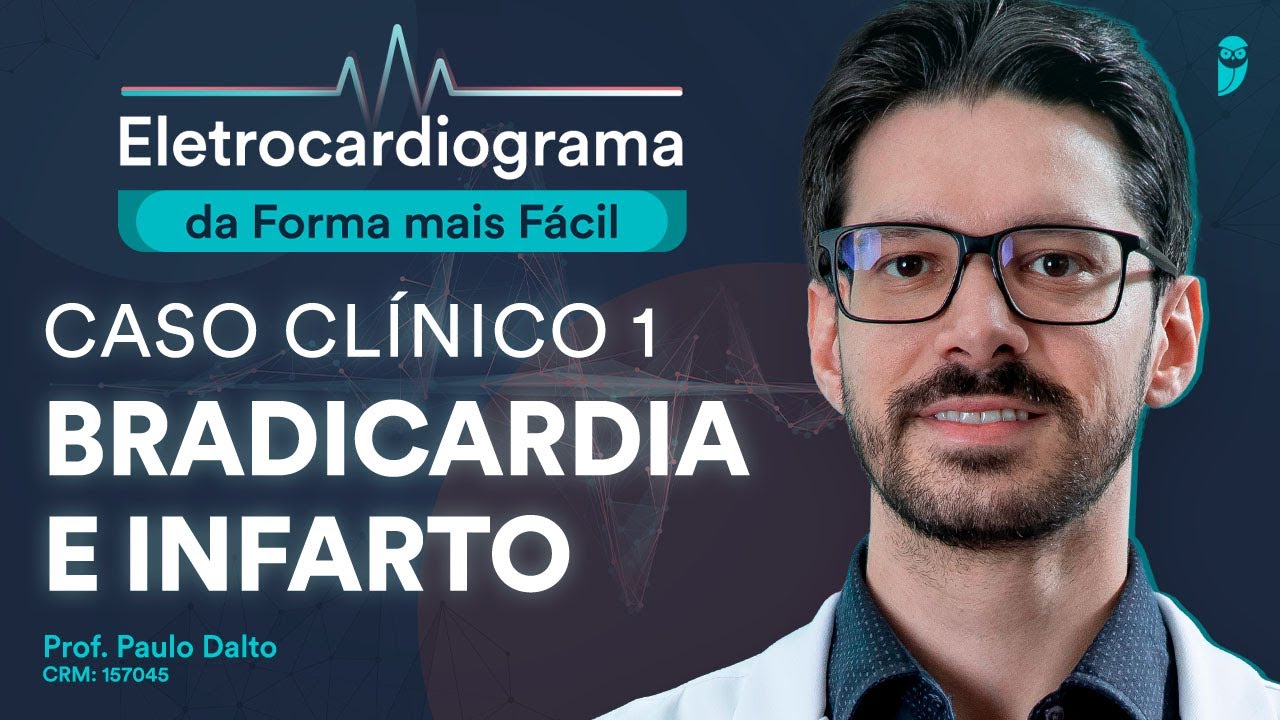 Caso Clínico 1 (Bradicardia e Infarto) - Eletrocardiograma da Forma mais Fácil