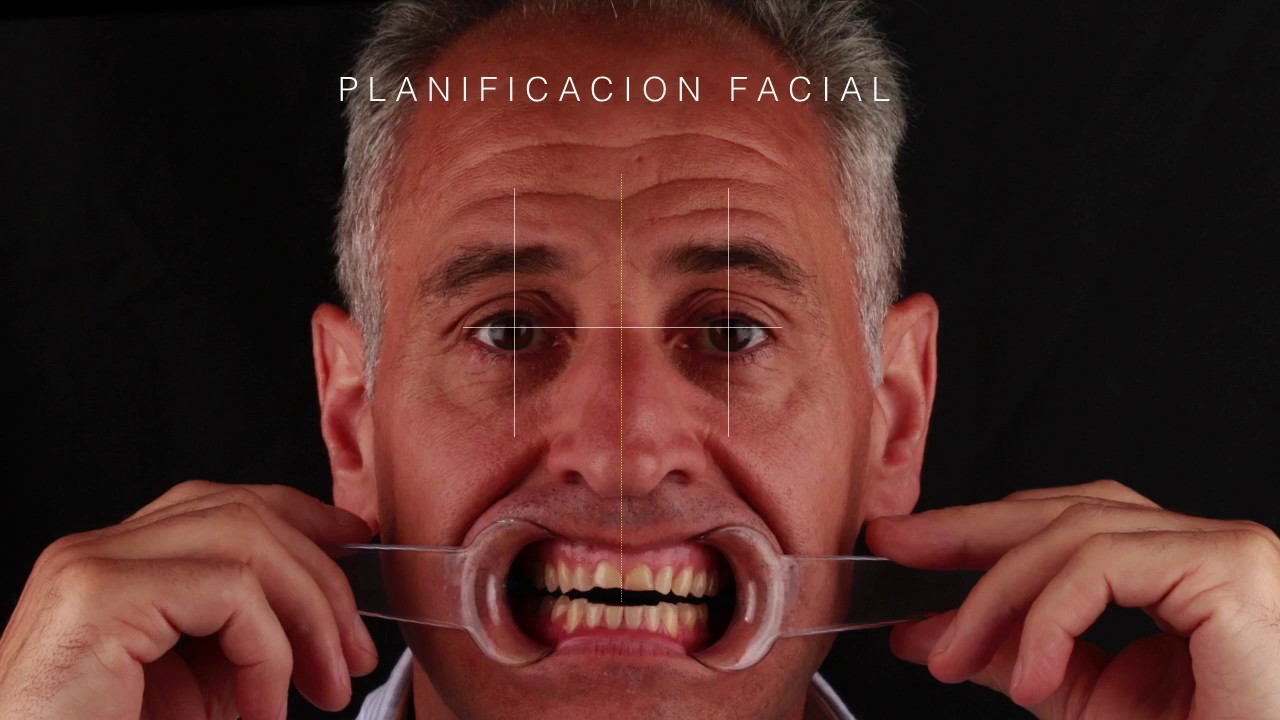 Gonzalo Navarro Boto-53