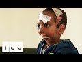 Boy has Jaw Ripped Off by Hyena | Body Bizarre