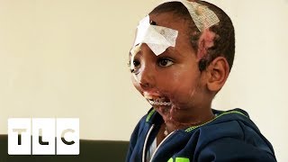 Boy has Jaw Ripped Off by Hyena | Body Bizarre