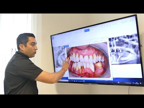 Videos from The Dental Suite - Leicester