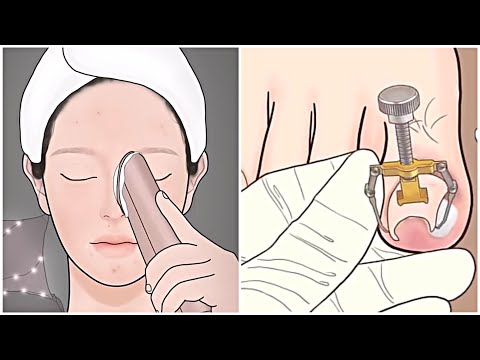 ASMR clean face squeeze pimples and clean toenails