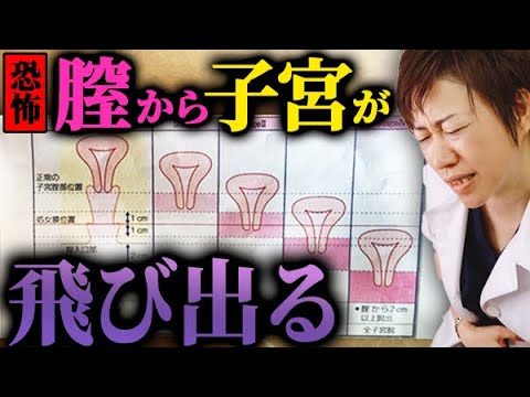 性器脱について詳しく解説