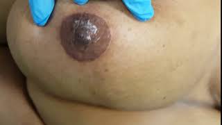 Nipple & Areola Medical Tattoo by El Truchan @ Perfect Definition