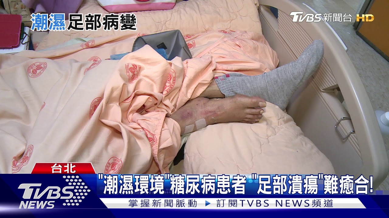 輕忽「足部小傷」罹患這個「病」　截肢風險高！